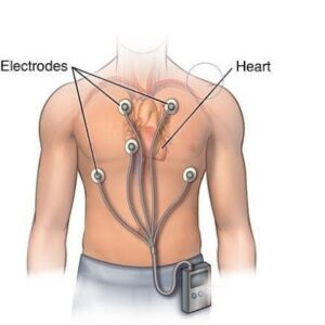 قراءة رسم القلب ECG Book PDF
